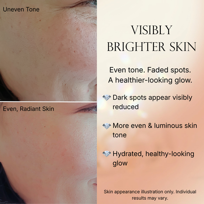 Caramela Beauty Even Tone Serum – Brightening Serum for Dark Spots & Hyperpigmentation with Kojic Acid, Hyaluronic Acid & Centella Asiatica – Radiant Healthy Glow – 1 fl oz / 30mL